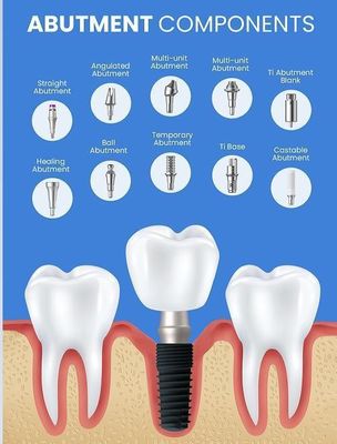 2D / 3D angepasste Zahnimplantate Prothese Abutment für schmale regelmäßige Nackenimplantate