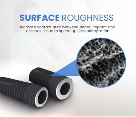 2D / 3D angepasste Zahnimplantate Prothese Abutment für schmale regelmäßige Nackenimplantate