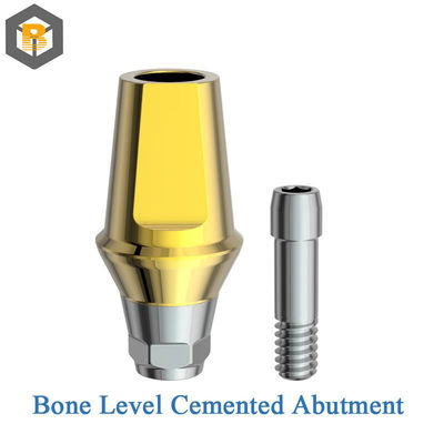 Unterwasser-Typ Inneres Hex-Titan-Implantat Knochenhöhe Zahnimplantat kompatibel mit Custom 3D-Design