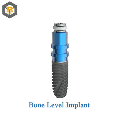 Custom 2D/3D Zahnimplantat Abutment Schraube Hexagon Außen für professionelle Zahnlabor