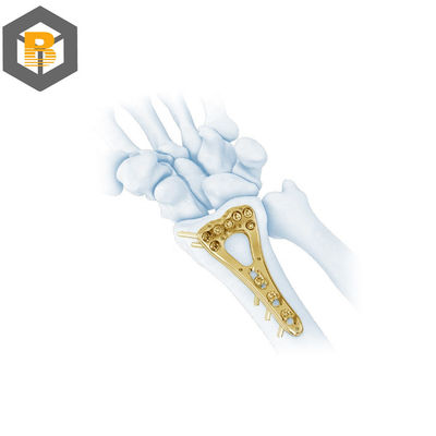 Teil zur Verarbeitung mit CNC-Präzisionsbearbeitung für den Nutzen von Multi-Axial Distal Radius Plum Locking Plate-II